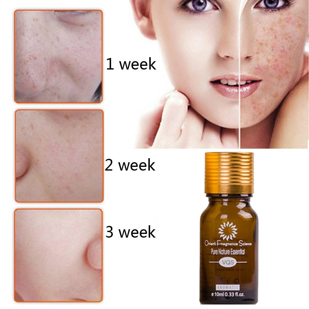 Dredge Meridian Skin Care Natural Pure Removal Acne Stretch Marks Scar Removal Essence oil - Balochistan LLC 